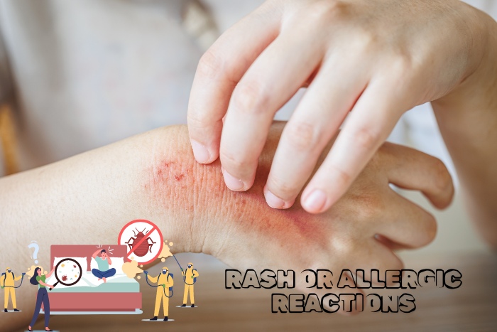 Close-up of a person scratching a rash caused by bed bugs, emphasizing the need for professional pest control services in Chennai. Get effective bed bug treatment with Professional Pest Management And Allied Services Pvt. Ltd. to avoid allergic reactions and infestations