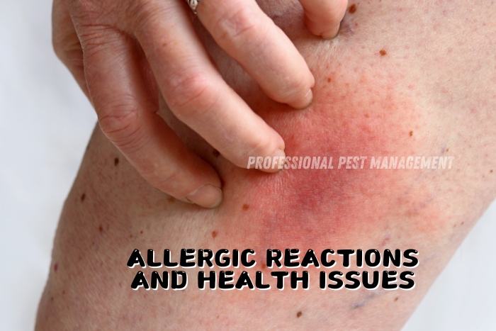 Professional Pest Management And Allied Services Pvt. Ltd. highlights the potential allergic reactions and health issues caused by pest infestations. The image shows a close-up of a person scratching a red, irritated area on their skin, indicating a possible allergic reaction. Recognizing these symptoms is crucial for homeowners in Chennai to seek timely pest control solutions and protect their health